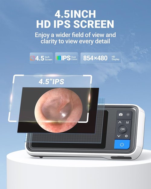 ScopeAround Otoscope - 4.5" IPS Screen Ear Camera with Gyroscope & Light | 32GB Card Included
