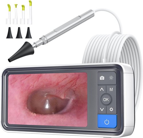 ScopeAround Otoscope - 4.5" IPS Screen Ear Camera with Gyroscope & Light | 32GB Card Included