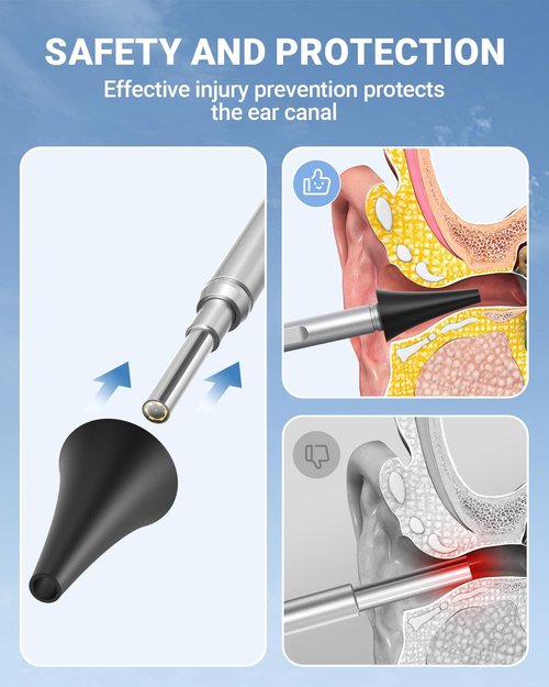 ScopeAround Otoscope - 4.5" IPS Screen Ear Camera with Gyroscope & Light | 32GB Card Included